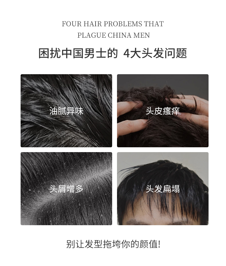 困擾中國男士的四大問題，油膩異味、頭皮瘙癢、頭屑增多、頭發(fā)扁塌